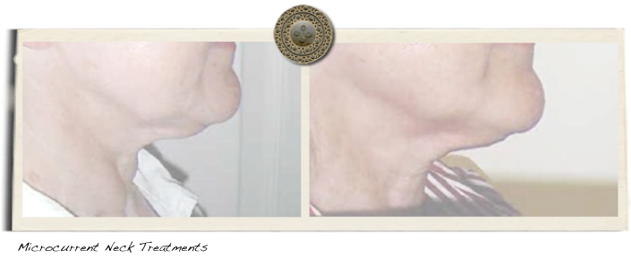 microcurrent neck treatments with Microcurrent System by Clareblend